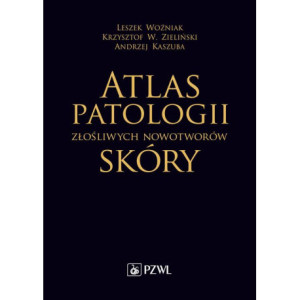 Atlas patologii złośliwych...