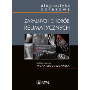 Diagnostyka obrazowa zapalnych chorób reumatycznych [E-Book] [mobi]