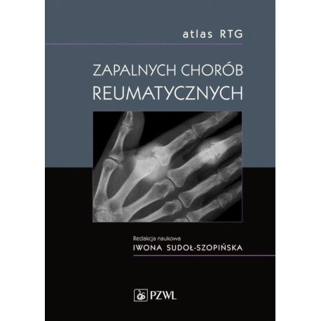 Atlas RTG zapalnych chorób reumatycznych [E-Book] [epub]