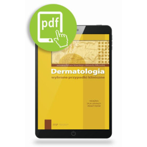 Dermatologia - wybrane przypadki kliniczne [E-Book] [pdf]