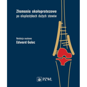 Złamania okołoprotezowe po aloplastykach dużych stawów [E-Book] [mobi]