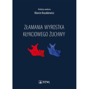 Złamania wyrostka kłykciowego żuchwy [E-Book] [epub]