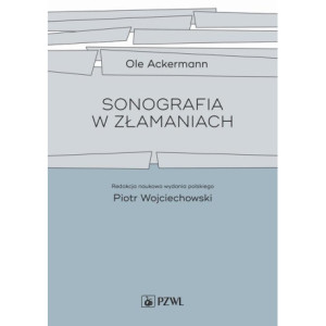 Sonografia w złamaniach [E-Book] [mobi]