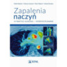 Zapalenia naczyń w praktyce klinicznej interdyscyplinarnie [E-Book] [mobi]