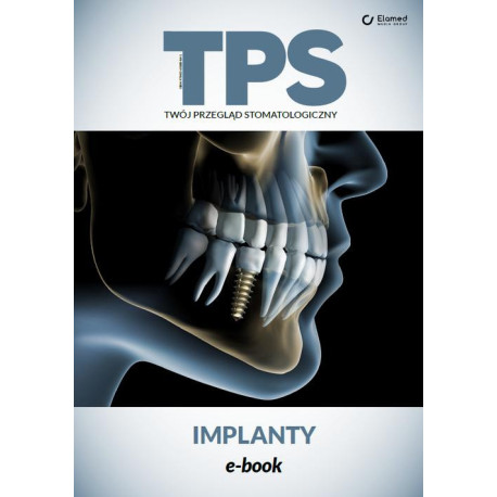 Implanty [E-Book] [pdf]